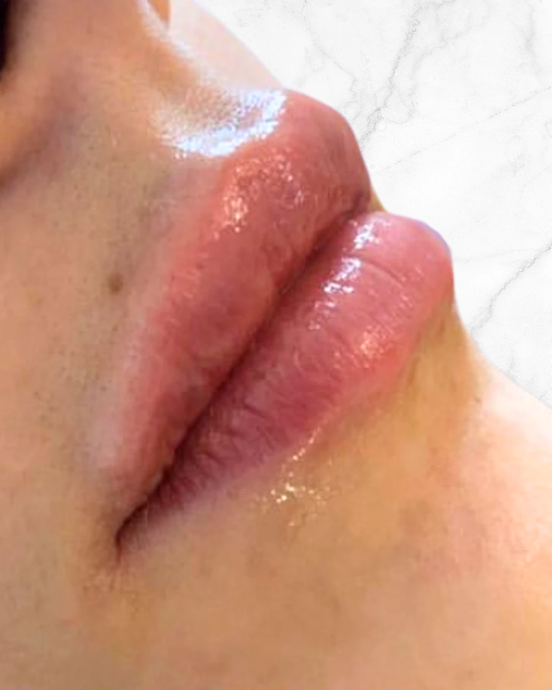 labios_1_after