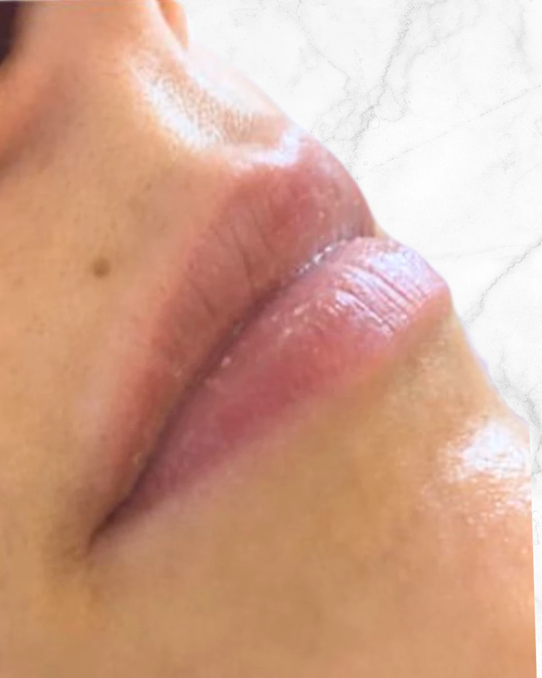 labios_1_before